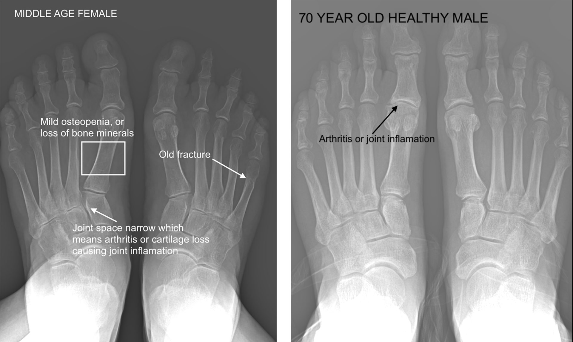 Diagnosing Age Related Changes