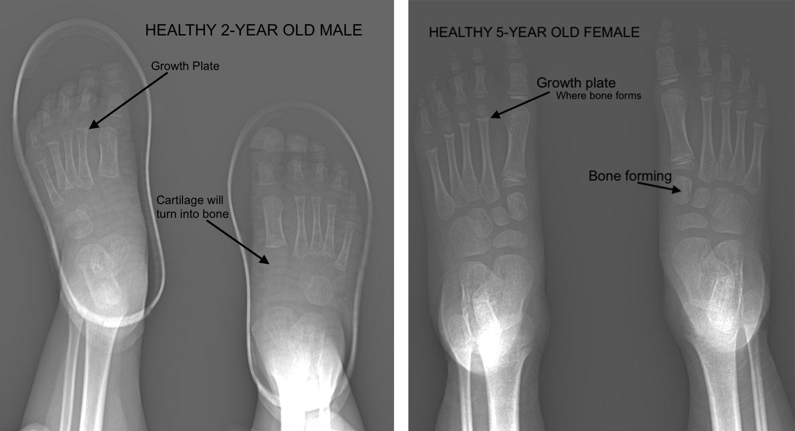 Diagnosing Age Related Changes