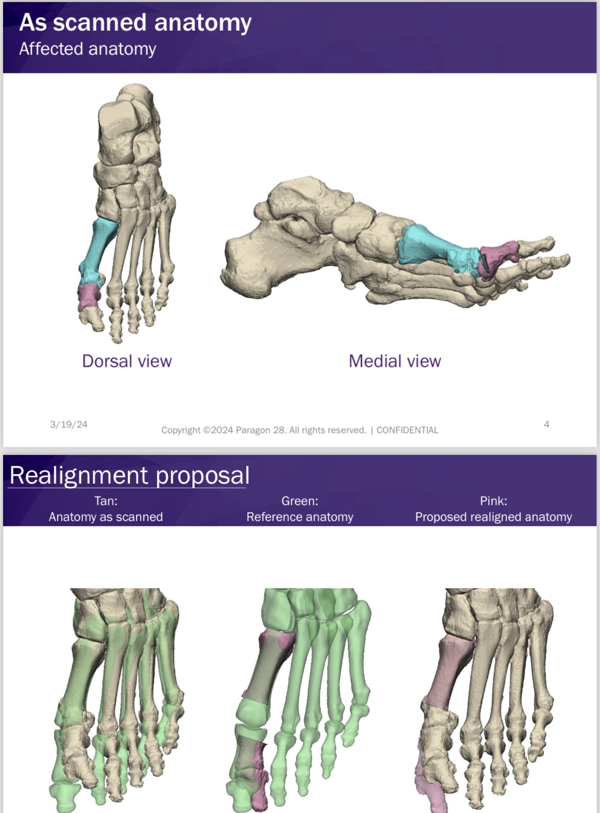 SURGERY 3D-DESIGNED JUST FOR YOU
