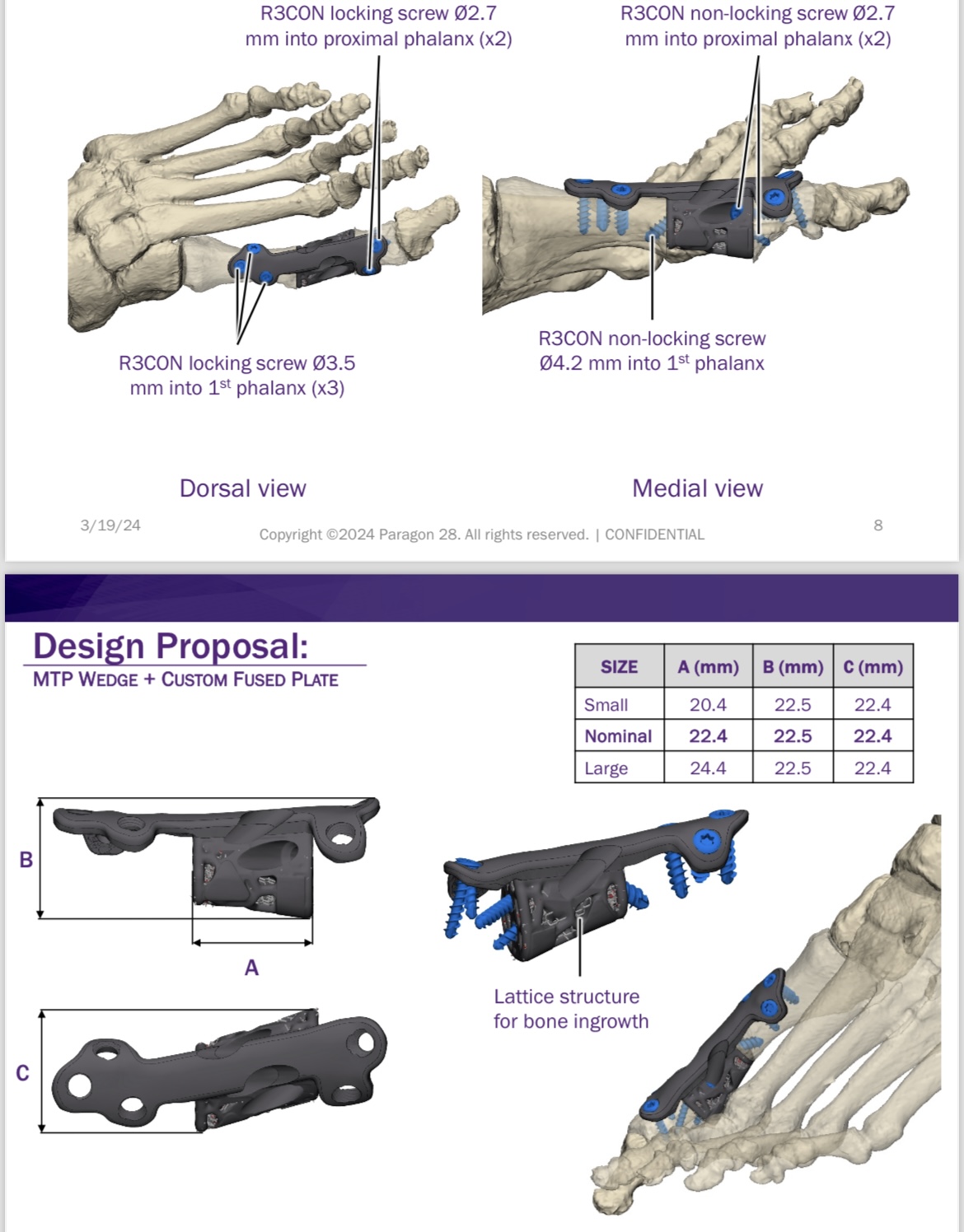 SURGERY 3D-DESIGNED JUST FOR YOU